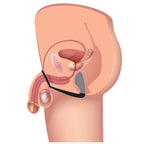 Explorer II Prostate Stimulator and Cock Ring